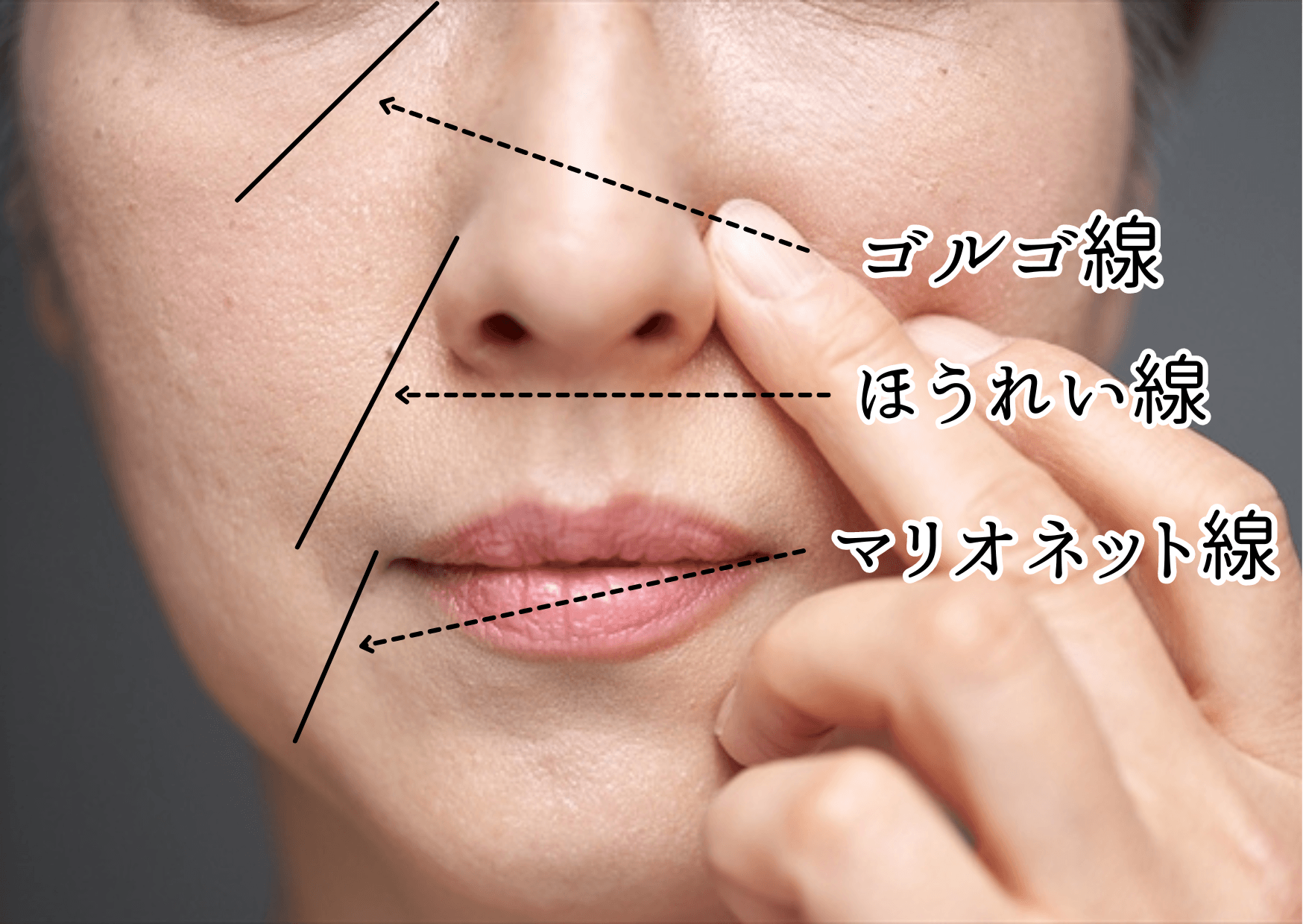 永遠のたるみ消し、始めよう♡