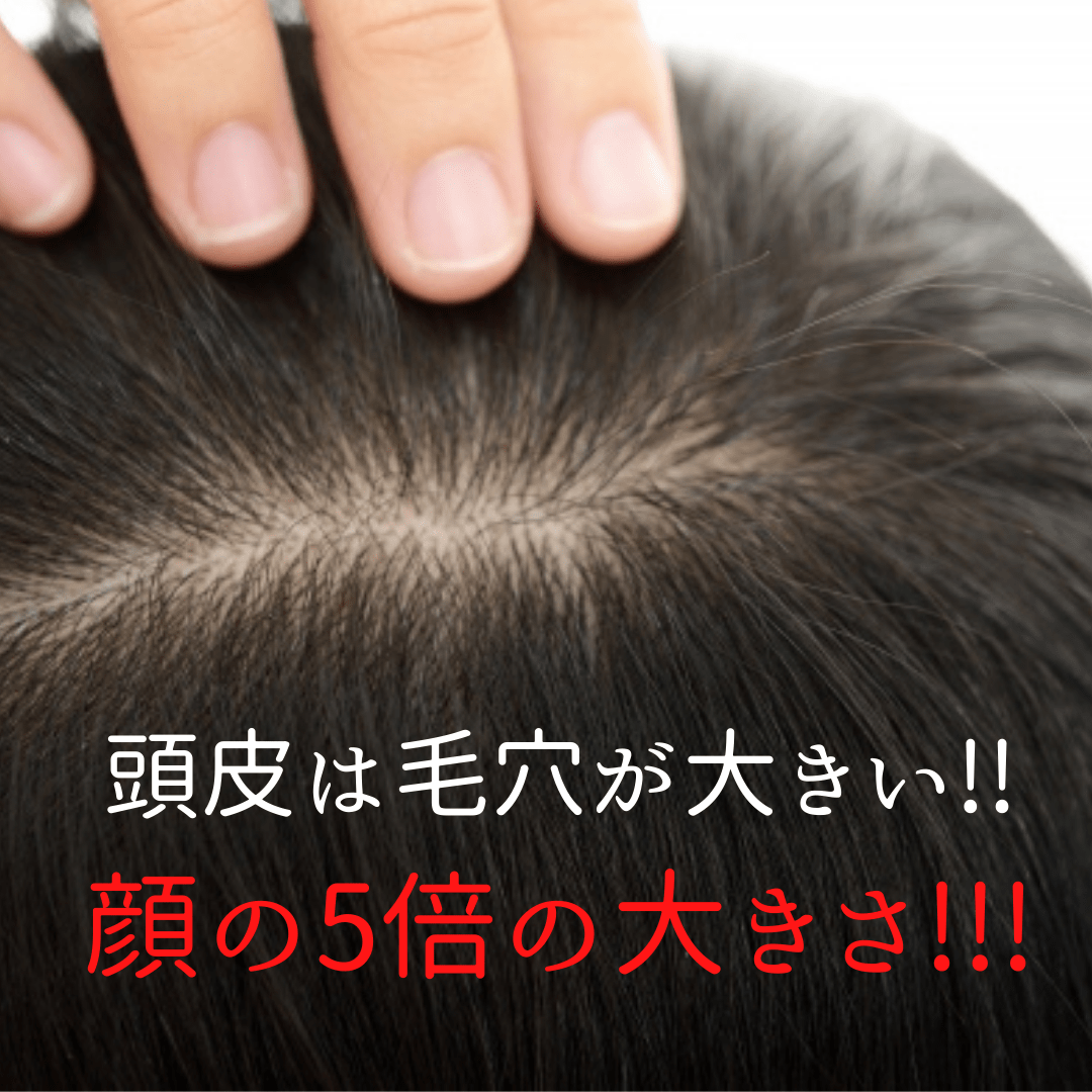 頭皮キャンペーンの症例写真、12/15が締め切りです♡